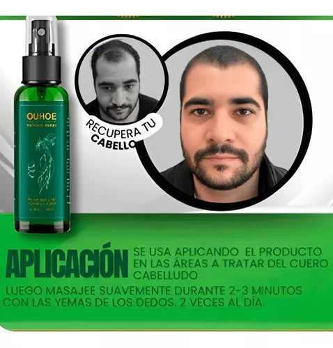 Spray Para Crecer El Pelo OUHOE