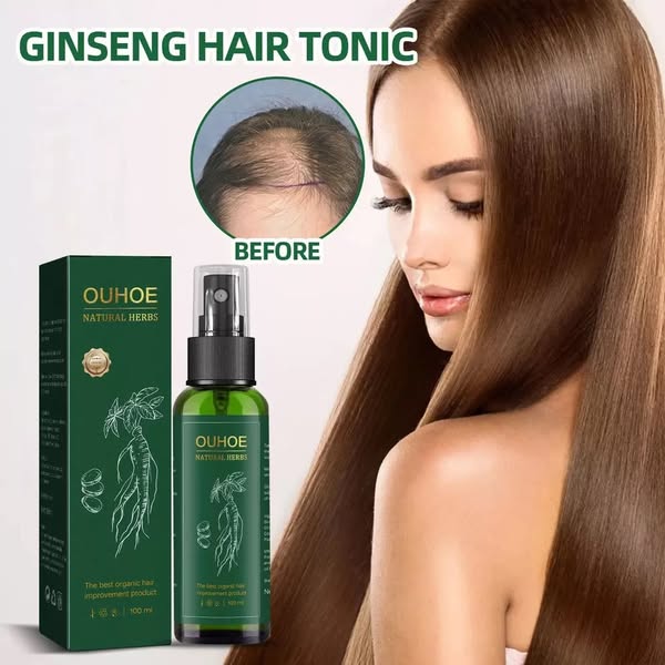 Spray Para Crecer El Pelo OUHOE