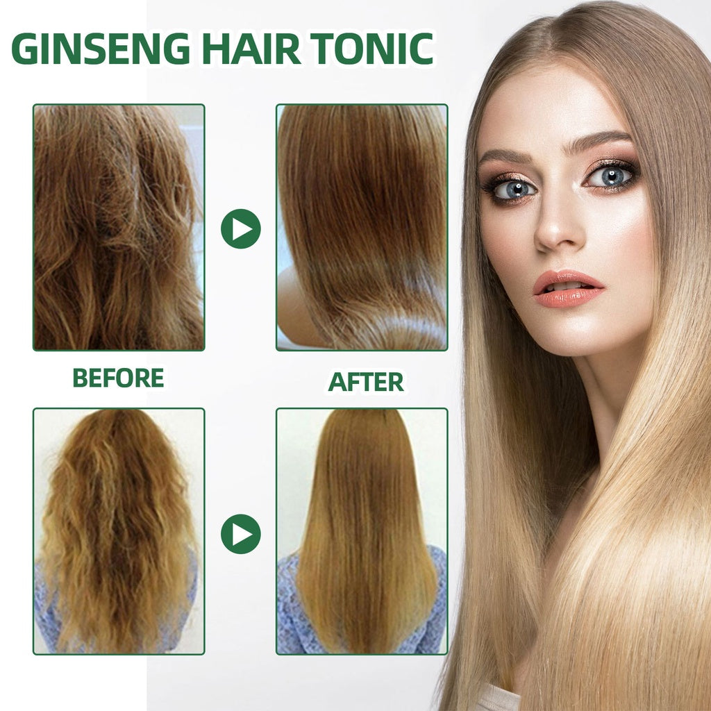 Spray Para Crecer El Pelo OUHOE